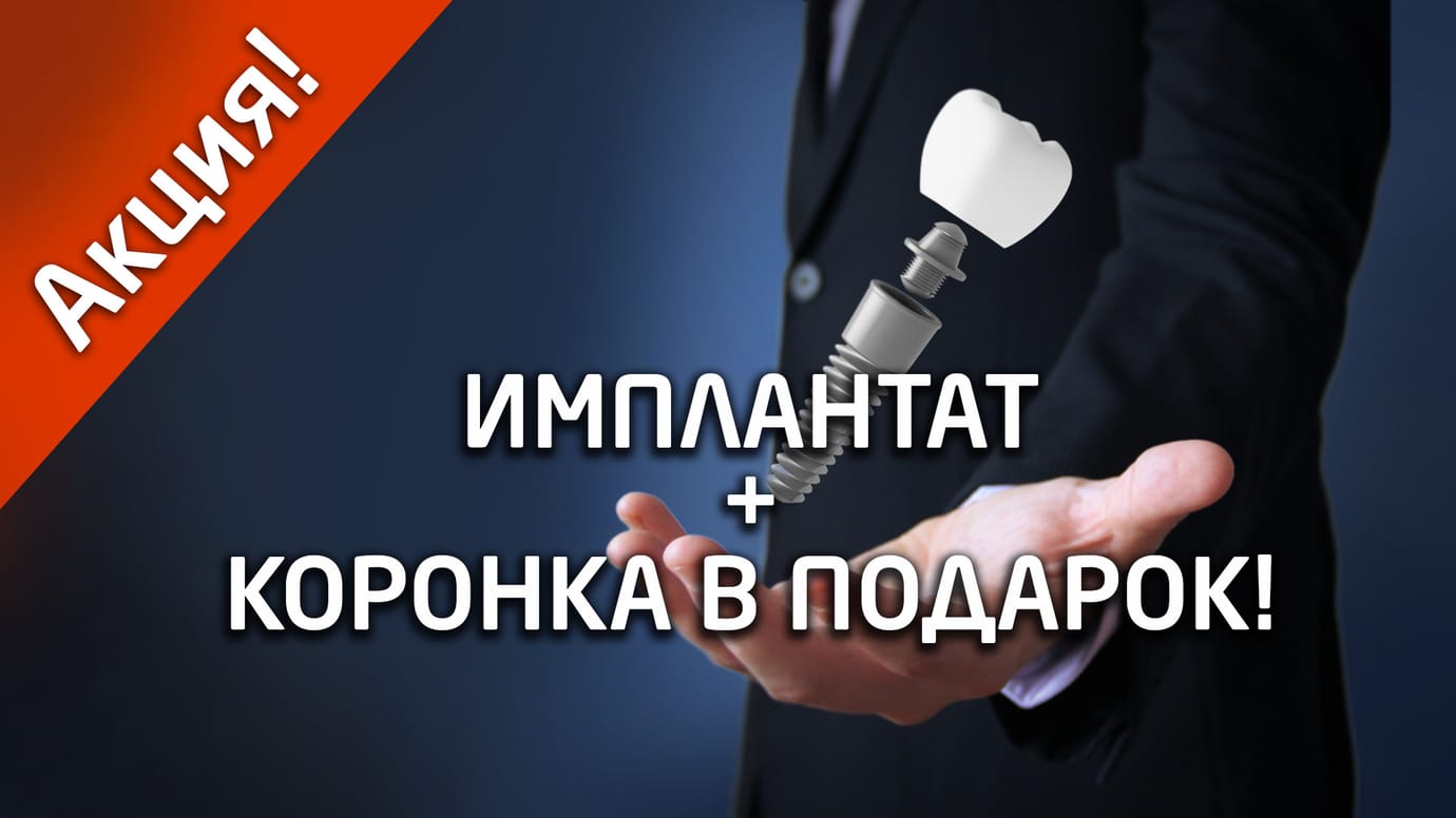 АКЦИЯ на имплантацию. Имплантация – 59 990 ₽. Коронка в подарок!