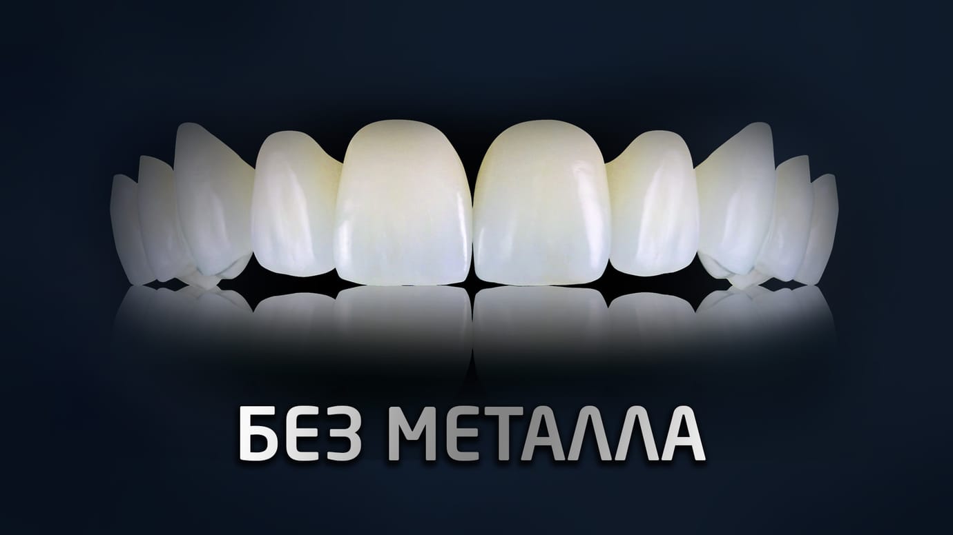 Безметалловая керамика. E-MAX. Диоксид циркония