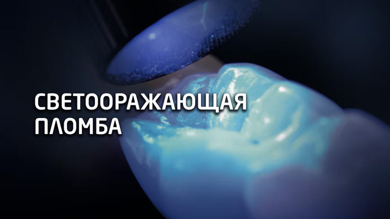 Эстетическая реставрация зубов