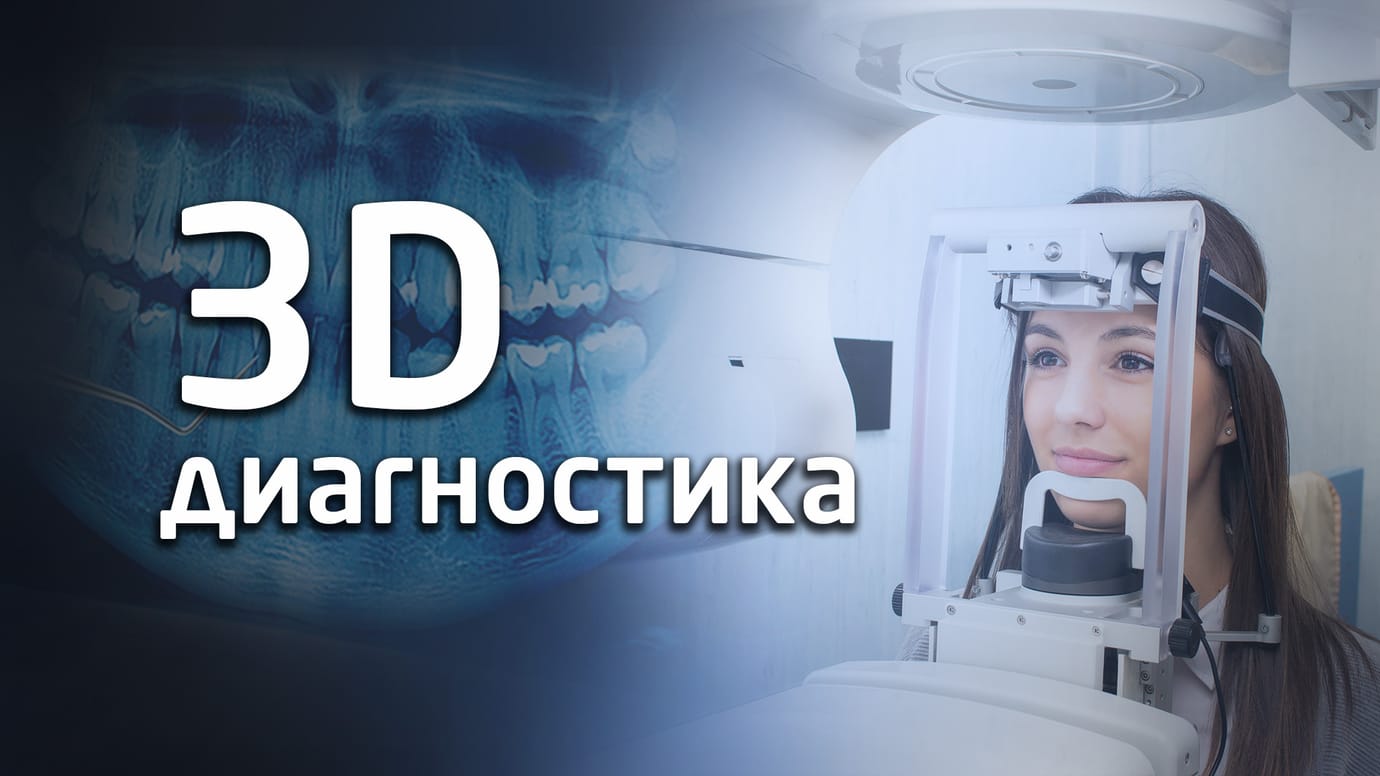 Компьютерная томография зубов. 3D диагностика зубов