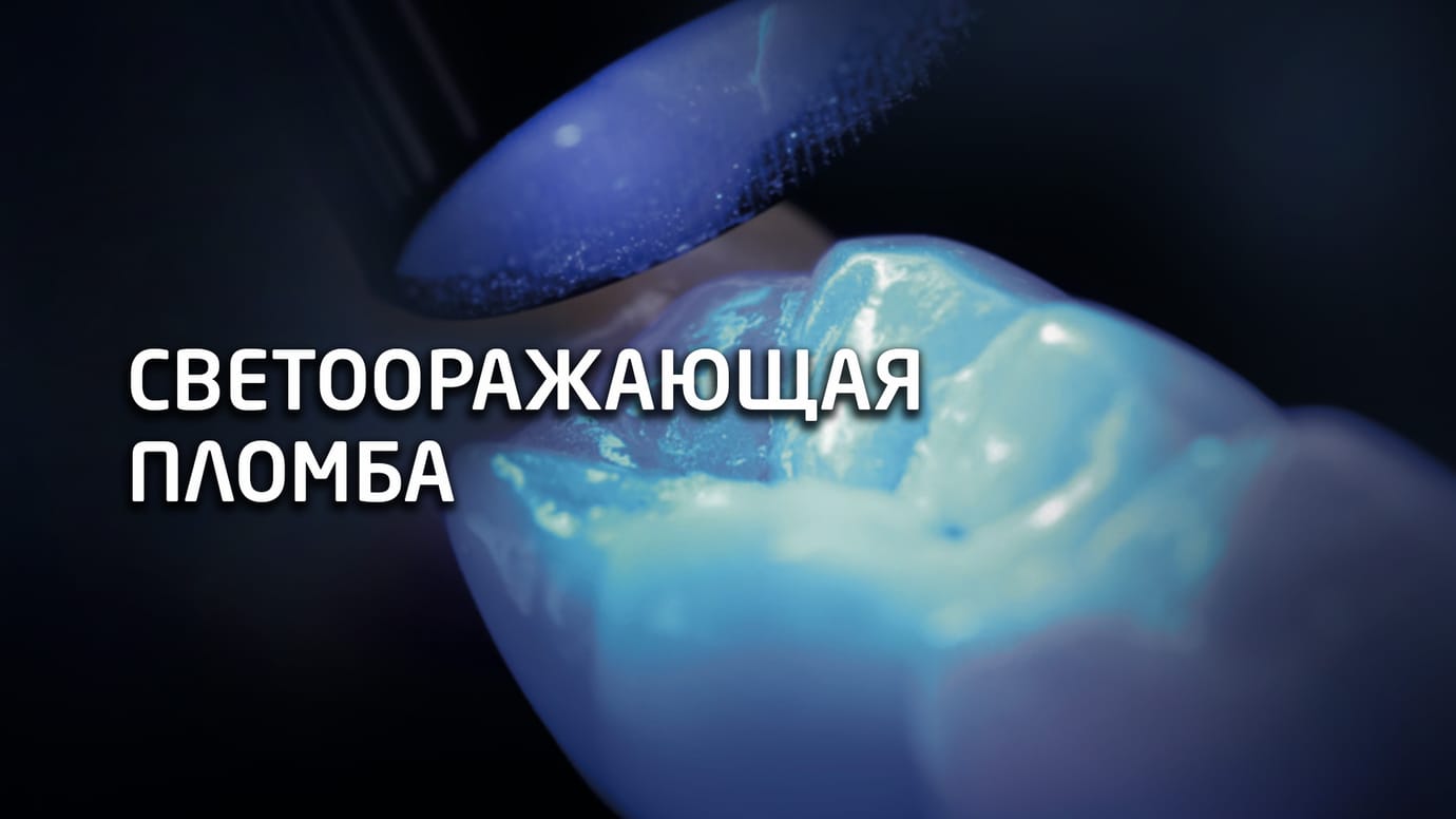 Светоотверждаемые пломбы. Керамические вкладки