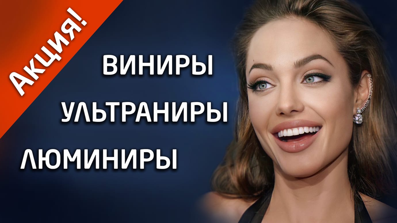 АКЦИЯ на виниры, ультраниры и люминиры.